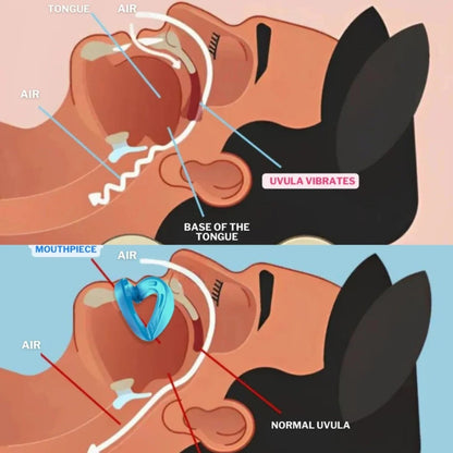Glamoara™ - Mouth Guard